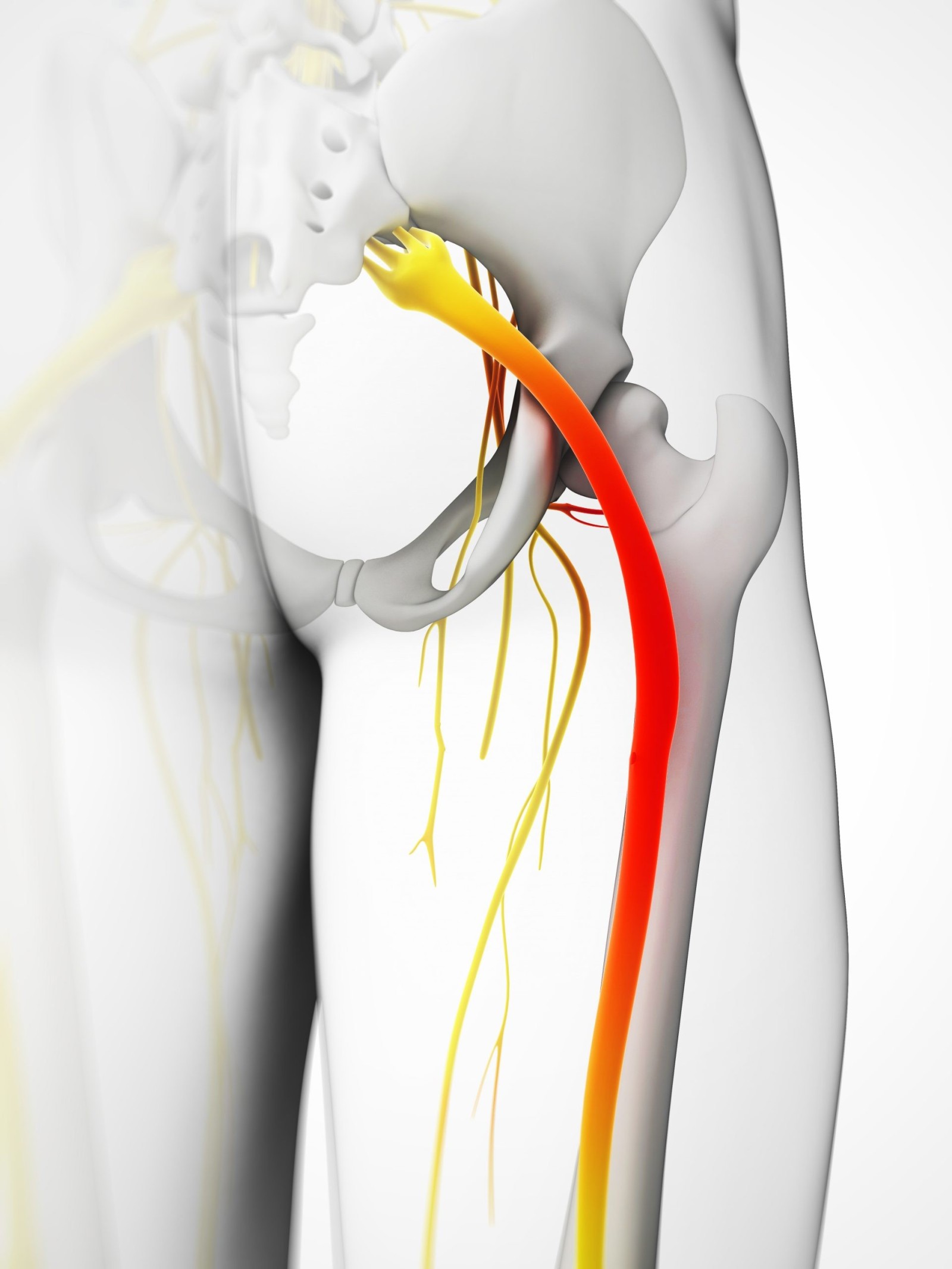 Dynamic Health, Jersey Chiropractor - Is it just a tight hamstring or ...